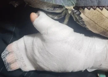 Mumbai Teacher Accused of Burning Student's Hands Over Handwriting Issues28 JUL