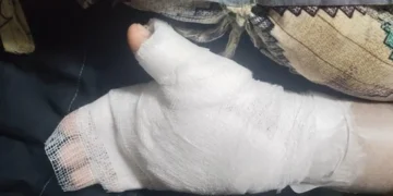 Mumbai Teacher Accused of Burning Student's Hands Over Handwriting Issues28 JUL